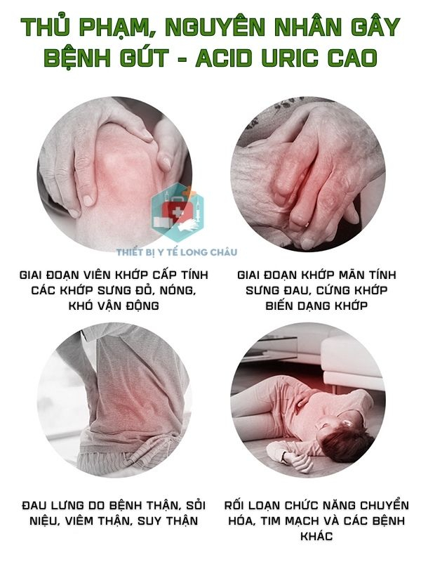 M&aacute;y Đo Acid Uric BeneCheck - Giải ph&aacute;p ti&ecirc;n tiến đo lường sức khỏe cho cả gia đ&igrave;nh