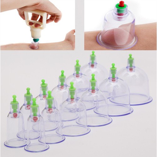 Bộ Gi&aacute;c Hơi 12 Cốc Kh&ocirc;ng D&ugrave;ng Lửa C&oacute; D&acirc;y Nối Hot