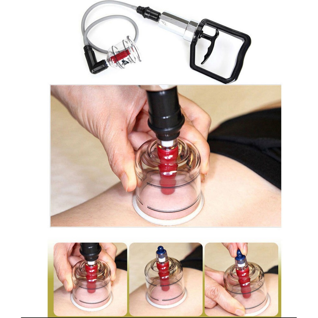 Bộ 19 cốc gi&aacute;c hơi giảm b&eacute;o m&aacute;t xa hỗ trợ chữa bệnh Hansol H&Agrave;N QUỐC Cao Cấp