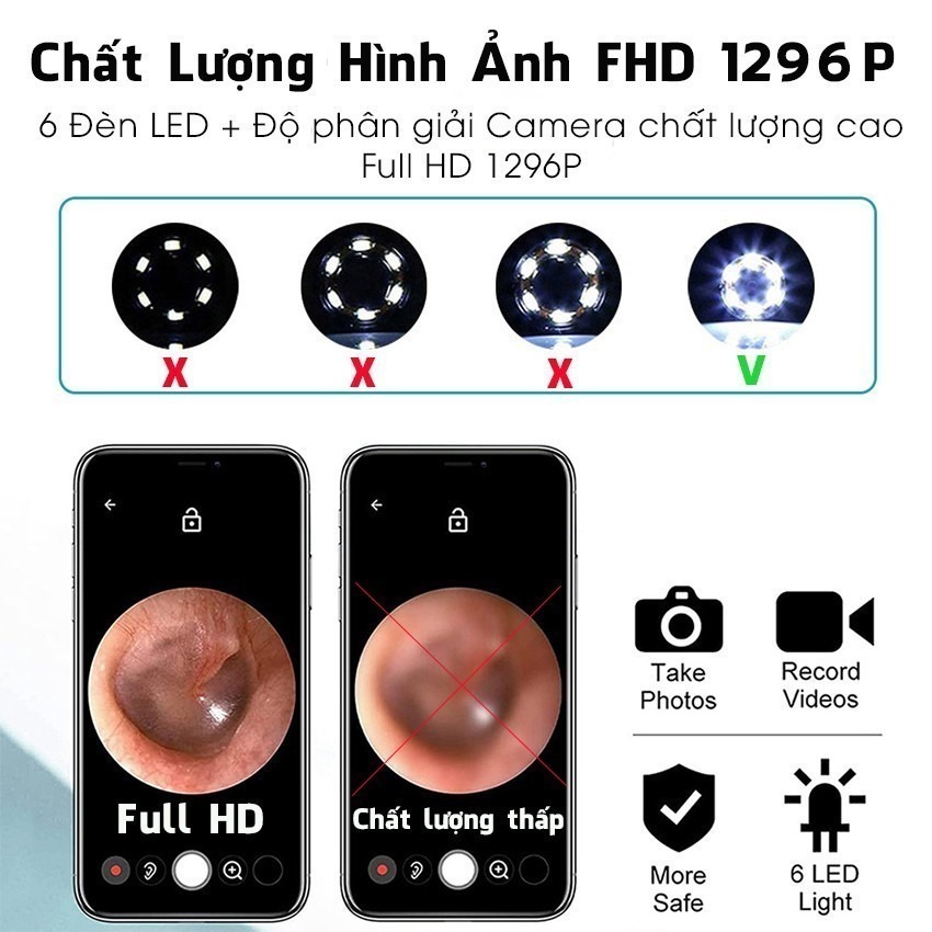 M&aacute;y Lấy R&aacute;y Tai Nội Soi NE3 Kh&ocirc;ng D&acirc;y, c&oacute; camera HD, H&igrave;nh Ảnh Sắc N&eacute;t, Điều Khiển Qua App Hot